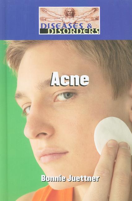 Acne